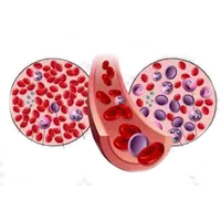 Ayurvedic Treatment for Blood Cancer